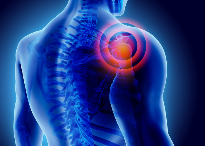 shoulder illustration pain